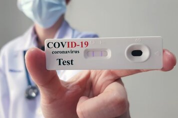 Pompeia realiza três vezes mais testes de COVID-19 que a média do Estado de São Paulo