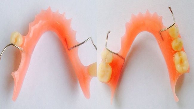 DHS entrega mais de 150 novas próteses dentárias em três meses 